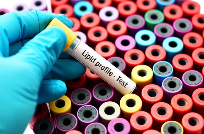 Peran Lipid Minor dalam Menjaga Kesehatan Kulit